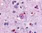 GRM1 / MGLUR1 Antibody (N-Terminus)