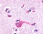 GRM2 / MGLUR2 Antibody (N-Terminus)