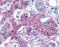 GRM8 / MGLUR8 Antibody (N-Terminus)