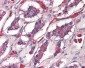 ADCYAP1R1 / PAC1 Receptor Antibody (N-Terminus)