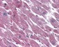 ADCYAP1R1 / PAC1 Receptor Antibody (N-Terminus)