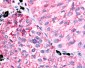 PTGER1 / EP1 Antibody (Cytoplasmic Domain)
