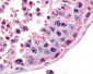 MC5R / MC5 Receptor Antibody (Extracellular Domain)