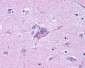 NPY5R Antibody (Cytoplasmic Domain)