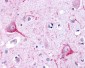 ADGRL2 / LPHN2 Antibody (N-Terminus)