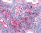 ADGRL2 / LPHN2 Antibody (C-Terminus)