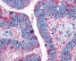 CCR10 / GPR2 Antibody (Extracellular Domain)