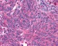 GLP1R / GLP-1 Receptor Antibody (N-Terminus)