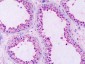 GPRC5A / RAI3 Antibody (Extracellular Domain)