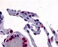 CCR1 Antibody (Extracellular Domain)