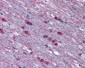 ADRA1A Antibody (Cytoplasmic Domain)
