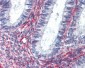 AGTR2 / AT2 Receptor Antibody (Internal)
