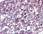 AGTR2 / AT2 Receptor Antibody (Internal)