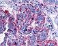 CHRM2 / M2 Antibody (Cytoplasmic Domain)
