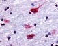 CHRM2 / M2 Antibody (Cytoplasmic Domain)