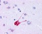 TACR1 /  NK1R Antibody (Extracellular Domain)