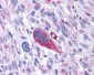 TACR1 /  NK1R Antibody (Extracellular Domain)