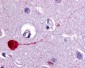 CHRM3 / M3 Antibody (Cytoplasmic Domain)