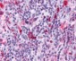 Leukotriene B4 Receptor / BLT1 Antibody (Cytoplasmic Domain)
