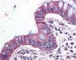 ADGRF5 Antibody (Internal)