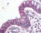 ADGRF5 Antibody (Internal)
