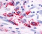 ADGRF5 Antibody (Cytoplasmic Domain)