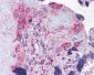 ADAMTS5 Antibody (Internal)