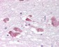 MCHR1 Antibody (C-Terminus)