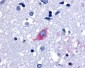 GPR48 / LGR4 Antibody (Cytoplasmic Domain)