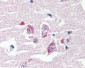 ADGRV1 / GPR98 Antibody (N-Terminus)