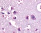 CRFR1 / CRHR1 Antibody (N-Terminus)