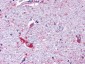 MRGPRF Antibody (N-Terminus)