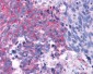 TAS1R2 / T1R2 Antibody (N-Terminus)
