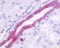 ADGRF1 Antibody (N-Terminus)