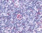 LTB4R2 / BLT2 Antibody (C-Terminus)