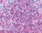 ADGRA2 / GPR124 Antibody (N-Terminus)