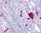 BRS3 Antibody (N-Terminus)