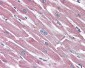 SSTR5 Antibody (Extracellular Domain)