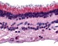 PTPRM / PTP Mu Antibody (Internal)