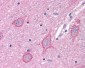 GRM3 / MGLUR3 Antibody (N-Terminus)