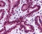 FAK / Focal Adhesion Kinase Antibody (Internal)