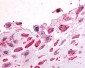 NEP / DDR1 Antibody (N-Terminus)