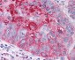 FZD1 / Frizzled 1 Antibody (N-Terminus)