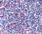 GPR44 / CRTH2 Antibody (Extracellular Domain)