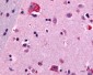 CNR1 / CB1 Antibody (N-Terminus)