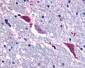 TACR3 / NK3R Antibody (C-Terminus)