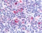 GPRC5D Antibody (Cytoplasmic Domain)
