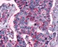 FZD5 / Frizzled 5 Antibody (Cytoplasmic Domain)