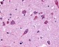 FZD8 / Frizzled 8 Antibody (N-Terminus)