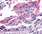 FZD7 / Frizzled 7 Antibody (N-Terminus)